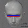 игла
